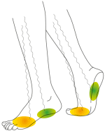 Druckverteilung mit in_it®